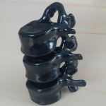vertebre