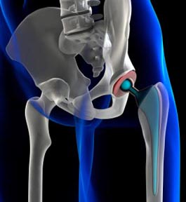 RESCOLL intervient dans la journée « Les TESTS PHYSIQUES dans les MATERIAUX IMPLANTABLES »