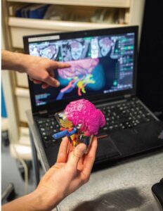 Impression 3D de modèles d’organes sur-mesure